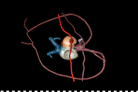 Modello anatomico Cuore di tartaruga 111 448 photo