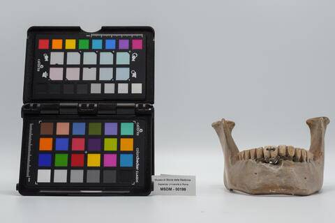 calco di protesi dentaria 00199 photo