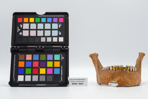 protesi dentaria 00204 photo