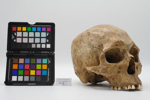 Cranio umano 0005 photo