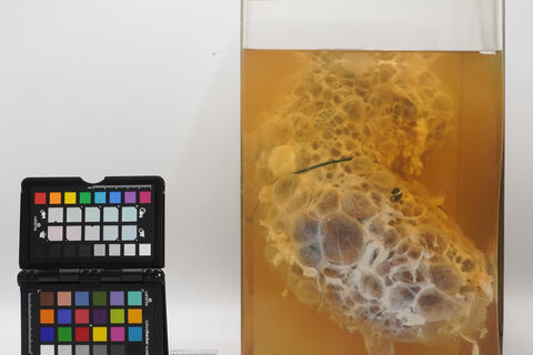 Preparato anatomico di rene policistico 2512 photo