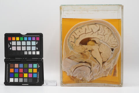 Sezione anatomica sagitalle mediana di testa umana 2523 photo