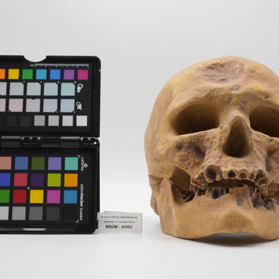 calco homo sapiens 00003 photo