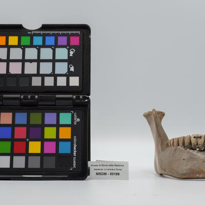 calco di protesi dentaria 00199 photo