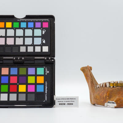 protesi dentaria 00204 photo