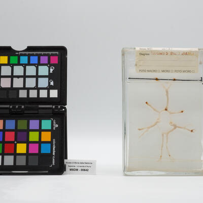 anatomie pathologique 00642 photo