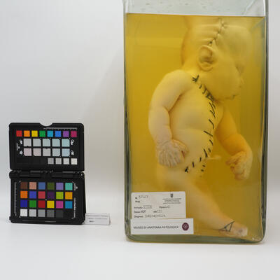 Preparato anatomico-diagnosi di sirenomelia 2518 photo