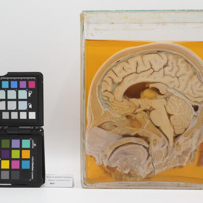 Sezione anatomica sagitalle mediana di testa umana 2523 photo