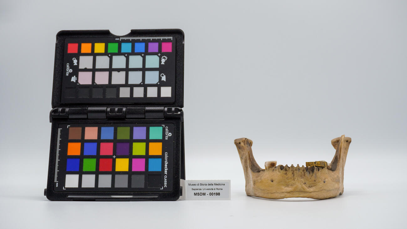 calco di protesi dentaria 00198 photo