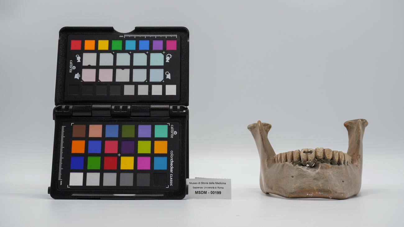 calco di protesi dentaria 00199 photo