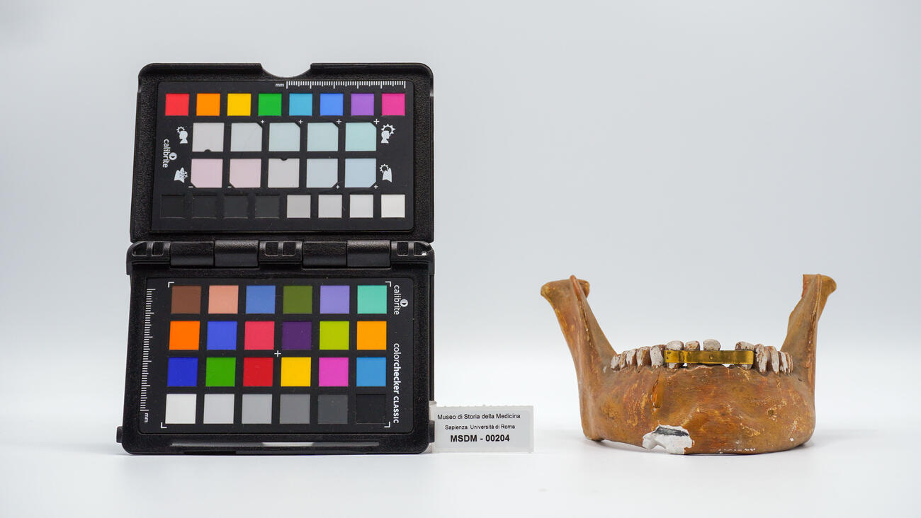 protesi dentaria 00204 photo