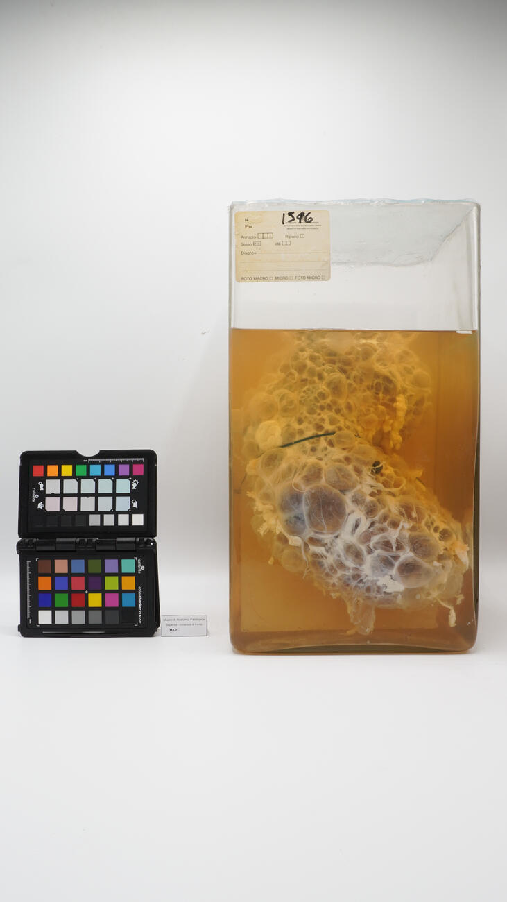 Preparato anatomico di rene policistico 2512 photo