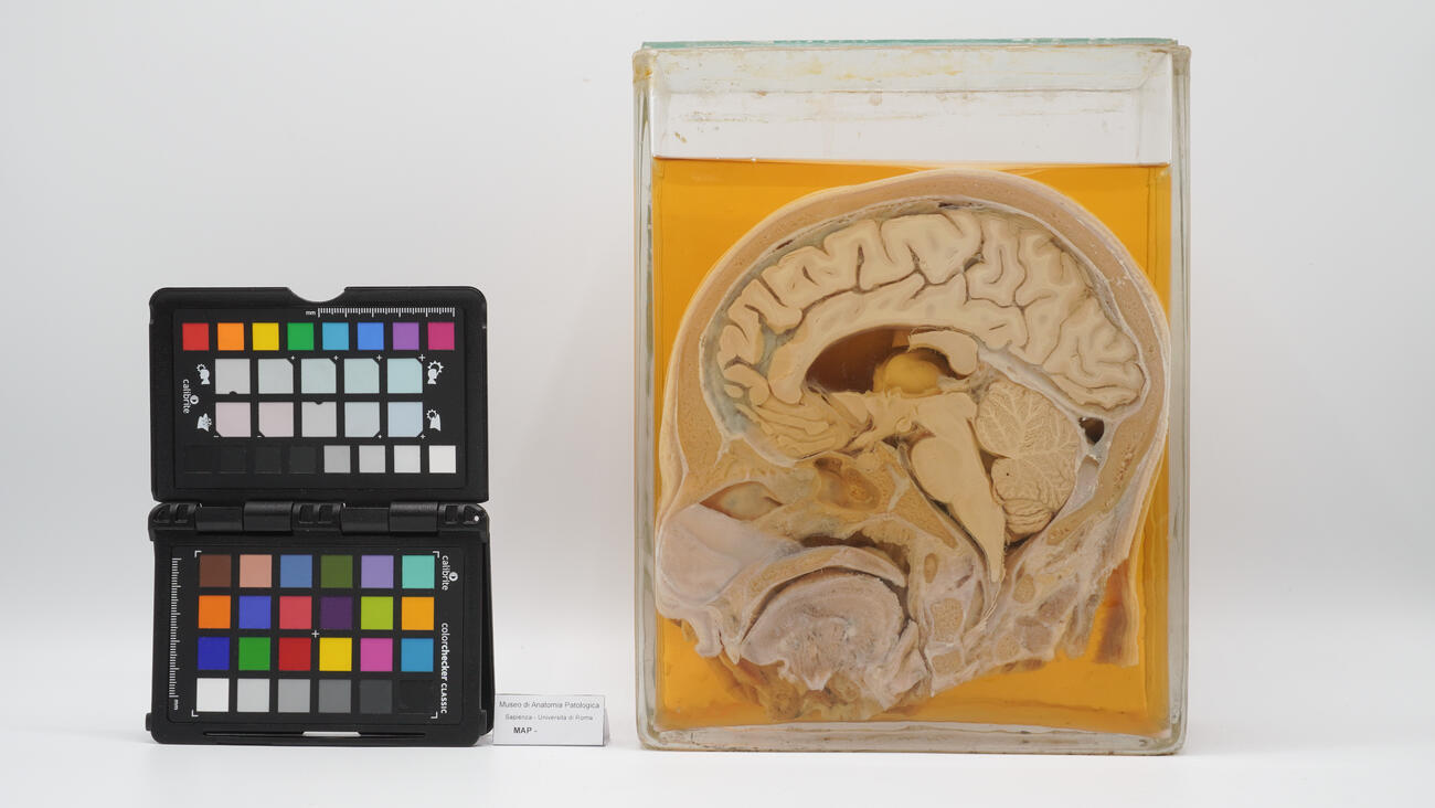 Sezione anatomica sagitalle mediana di testa umana 2523 photo